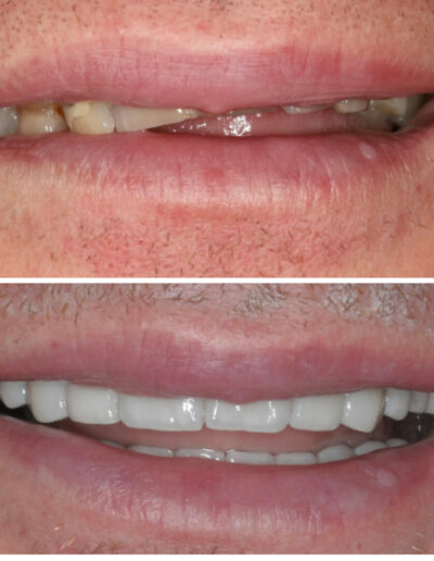 Nowy uśmiech Siedlce