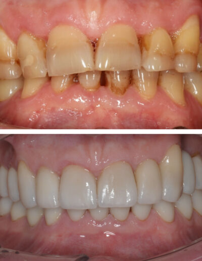 Metamorfoza Dentysta Siedlce