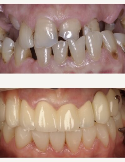 Przemiana uśmiechu Siedlce