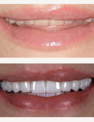 Metamorfoza uśmiechu