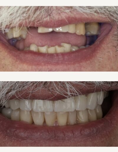 Metamorfoza usmiechu Siedlce