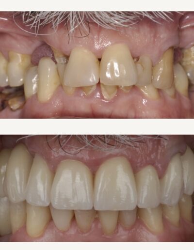 Przemiana uśmiechu Siedlce