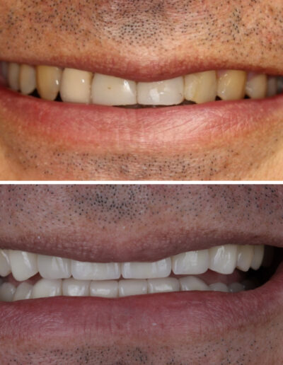 Estetyka uśmiechu Siedlce