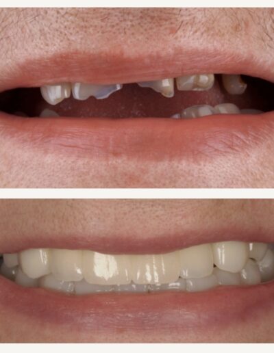 Nowy uśmiech Siedlce