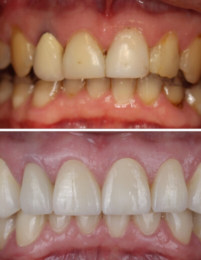 Metamorfoza uśmiechu