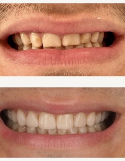 Metamorfoza Dentysta Siedlce