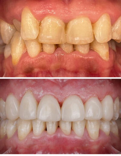 Przemiana uśmiechu Siedlce