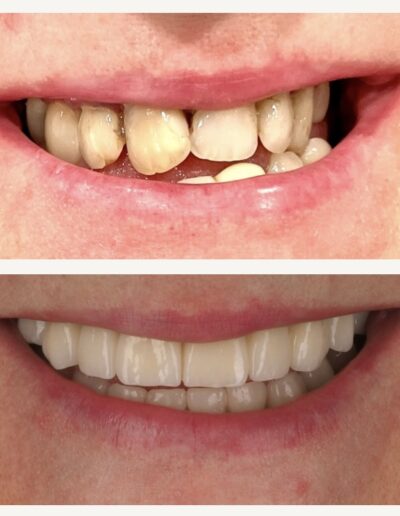 Piękny uśmiech Siedlce