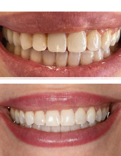 Metamorfoza usmiechu Siedlce