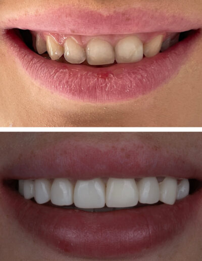 Nowy uśmiech Siedlce