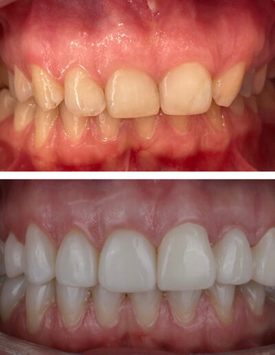 Piękny uśmiech Siedlce